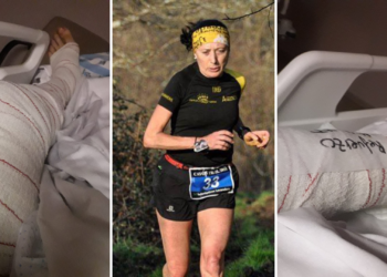 La gijonesa Carmen S. Corujo, atacada brutalmente por dos perros en Tremañes: «Estoy viva de milagro»