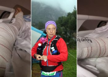 Carmen Corujo ya se recupera en casa tras el ataque de los perros que sufrió en Tremañes