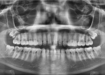 La inteligencia artificial de la Universidad de Oviedo ya sabe decir si alguien es mayor de edad